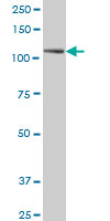 WB - PTK7 Antibody (monoclonal) (M02) AT3488a
